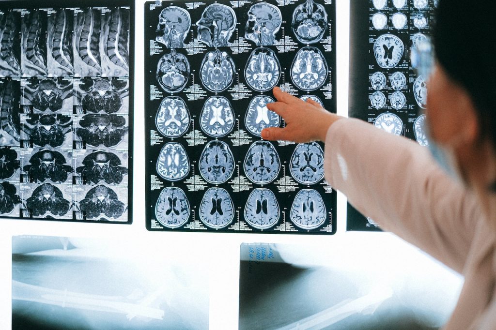 X-ray images