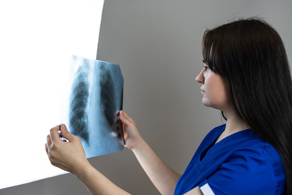 Caucasian female doctor examining Xray lungs in clinic. Healthcare, medical occupation